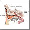 Ear tube insertion- series