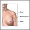 Breast lump removal- series