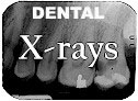 Dental xray